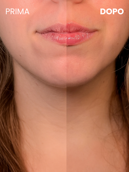 Silky Lips Peptide Mask