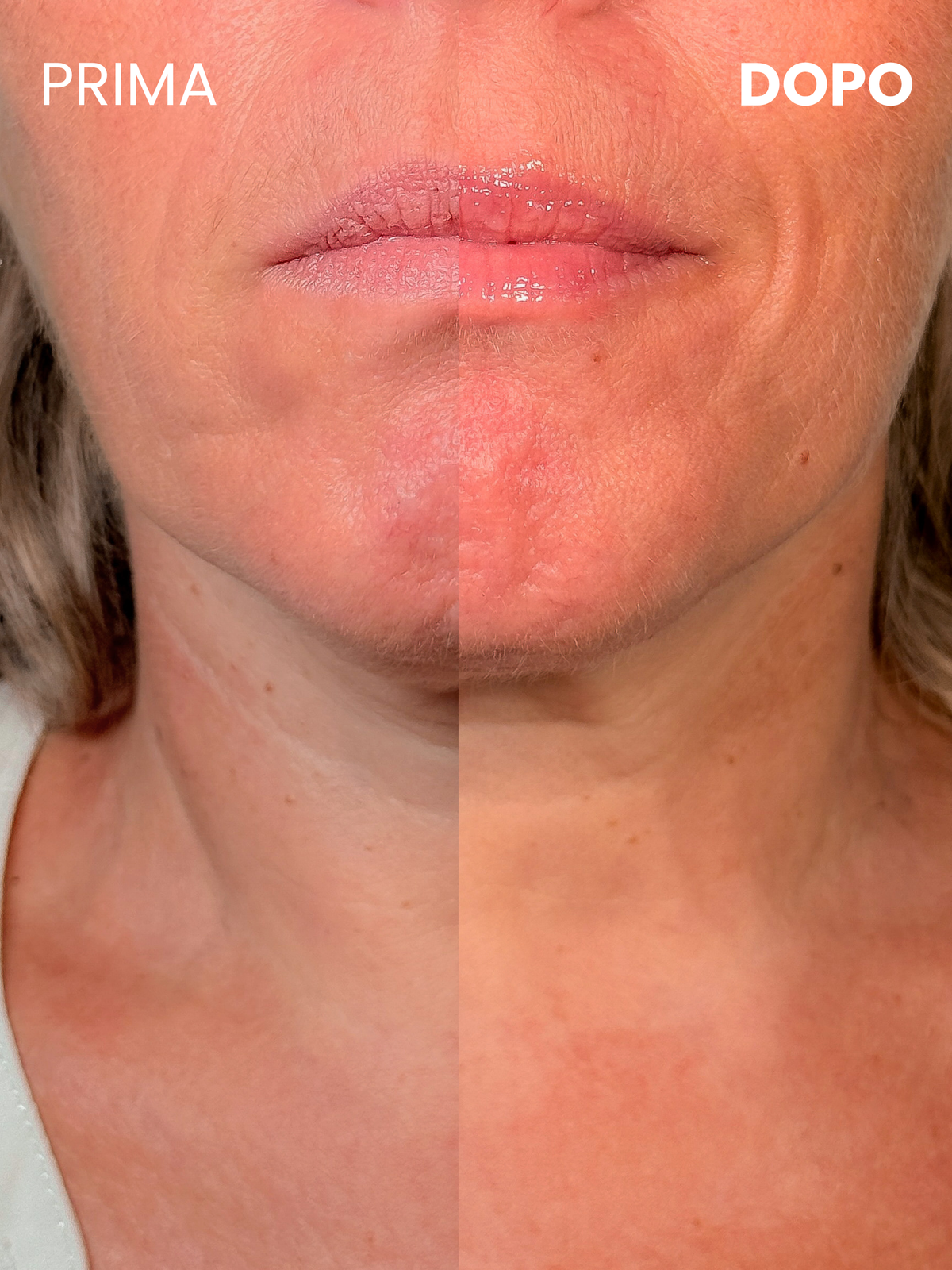 Silky Lips Peptide Mask