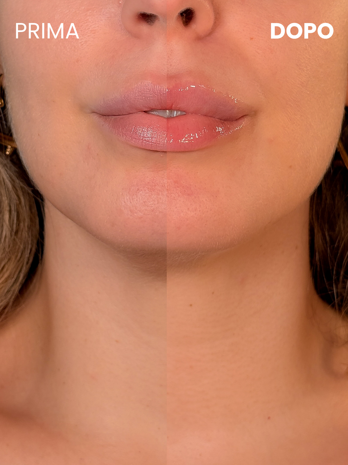 Silky Lips Peptide Mask